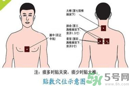 三伏貼能治頸椎病嗎？頸椎病三伏貼穴位