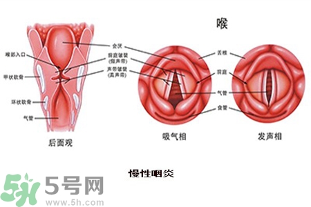 慢性咽炎是什么？慢性咽炎的癥狀有哪些？