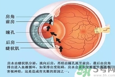 青光眼是什么？青光眼癥狀有什么？