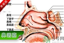 鼻咽癌的發(fā)病因素是什么？鼻咽癌的并發(fā)癥有哪些？