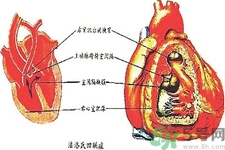 先天性心臟病可以用藥物治療嗎？