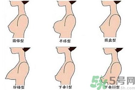 ?女性乳房下垂的原因是什么？女性乳房下垂的分類有哪些？