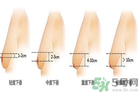 胸部松弛的原因是什么？胸部松弛該怎么辦？