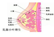 乳腺增生治療方法是什么？乳腺增生的檢查方法有哪些？