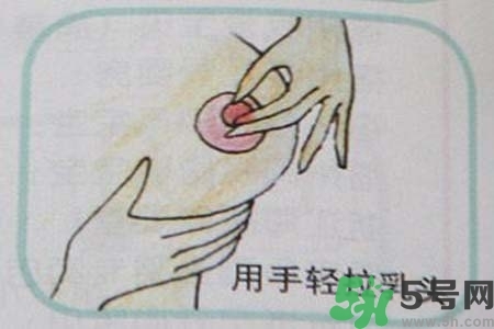 乳頭內(nèi)陷怎么矯正？乳頭內(nèi)陷矯正方法是什么？