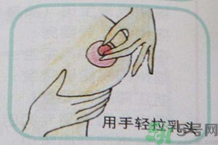 乳頭內(nèi)陷可以拔罐嗎？乳頭內(nèi)陷需要手術(shù)治療嗎？