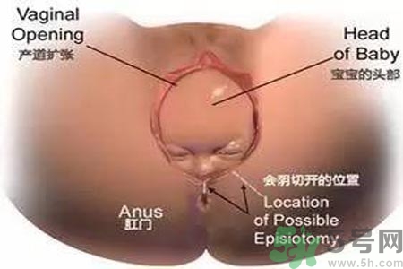 陰道松弛有什么危害？?陰道松弛恢復(fù)的方法有哪些？