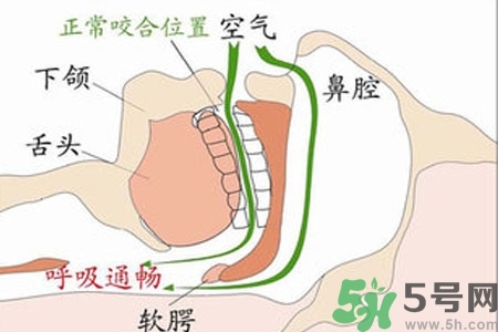 鼻子紅是什么原因？鼻子紅怎么辦？