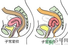 ?子宮移位怎么治療？子宮移位能懷孕嗎？