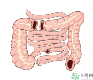 腸炎肚子疼怎么辦？腸炎肚子疼怎么緩解？
