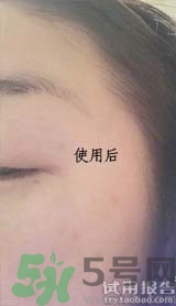 dr.jart適合什么年齡層？蒂佳婷適合年齡