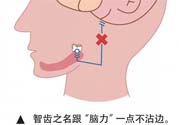 長智齒疼痛怎么辦？長智齒牙齦腫了怎么辦？