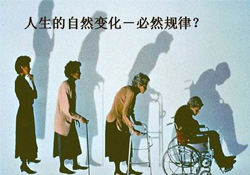 哪些人容易得骨質(zhì)疏松癥？骨質(zhì)疏松的高發(fā)人群有哪些？