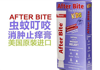 after bite止癢膏好用嗎？after bite止癢膏怎么樣？