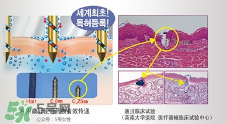 珠兒麗蚊子針好用嗎？珠兒麗蚊子針副作用