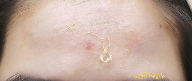 real skin patch怎么樣？real skin是什么牌子