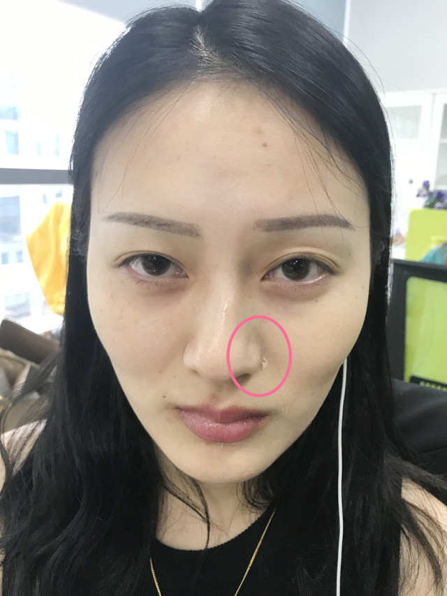 real skin patch怎么樣？real skin是什么牌子