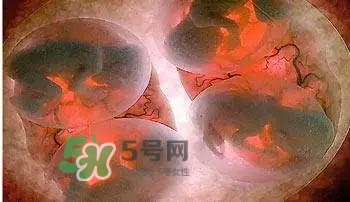 多胞胎順產(chǎn)怎么生？多胞胎剖腹產(chǎn)和單胎剖腹產(chǎn)的區(qū)別