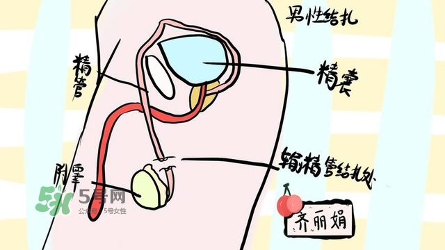 生完二胎一定要結(jié)扎嗎？生完二胎結(jié)扎好不好？