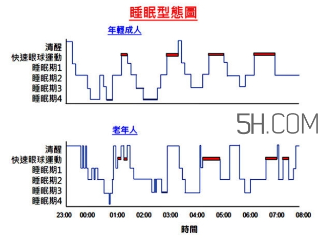 睡眠不足會(huì)促使大腦功能衰退嗎?