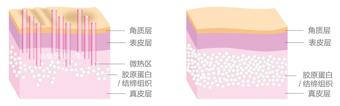 11款網(wǎng)紅美容儀器排行榜2018 是噱頭還是真本事