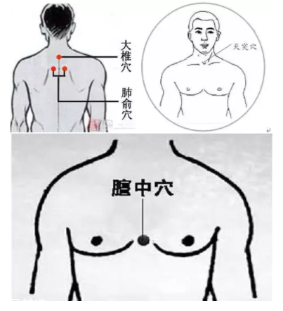 吮痧有什么療效？最溫柔的治病方法