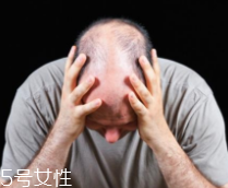 脫發(fā)有沒有治？只要不是禿子就有得治