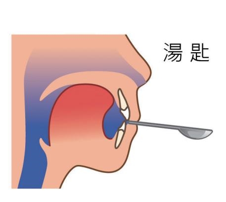 鼻塞怎么快速通氣 含溫水擺頭3分鐘