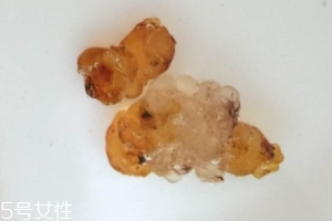 桃膠可以用開水泡嗎？用開水泡桃膠好嗎？