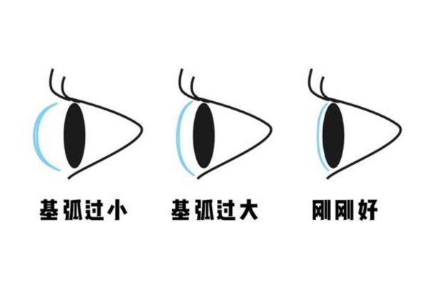 隱形眼鏡基弧大好還是小好 一般是寧大勿小