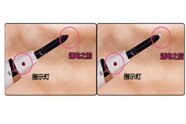 電睫毛器怎么用 燙睫毛器排行榜