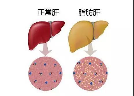 騎自行車對脂肪肝有用嗎 騎自行車對頸椎病有幫助嗎