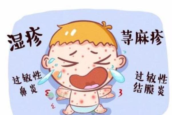 寶寶濕疹是什么原因造成的 寶寶濕疹怎么護(hù)理