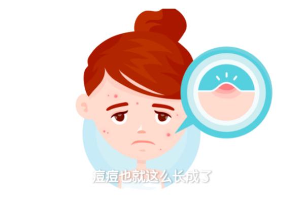 粉刺是痤瘡嗎 粉刺是螨蟲造成的嗎