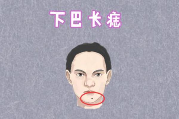 點(diǎn)痣是激光好還是藥水好 點(diǎn)痣是去醫(yī)院好還是美容院好