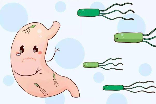 感染幽門螺旋桿菌后有哪些癥狀 幽門螺旋桿菌是什么