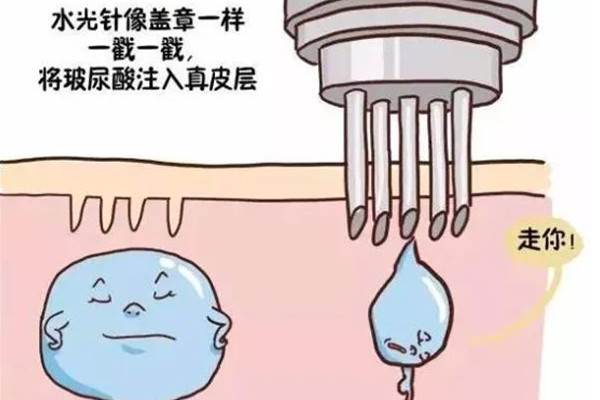 水光針要打幾次才看得到效果 水光針幾針一個(gè)療程