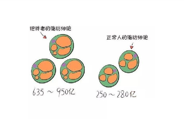 吸脂可以一次性全身吸嗎 吸脂可以吸哪些部位